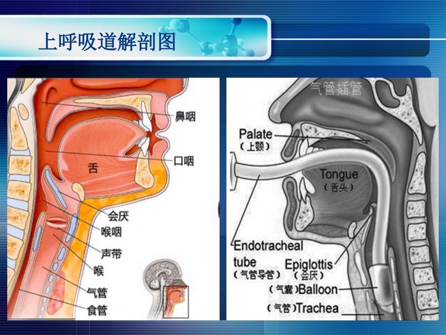 吸痰技术与应用_第3页