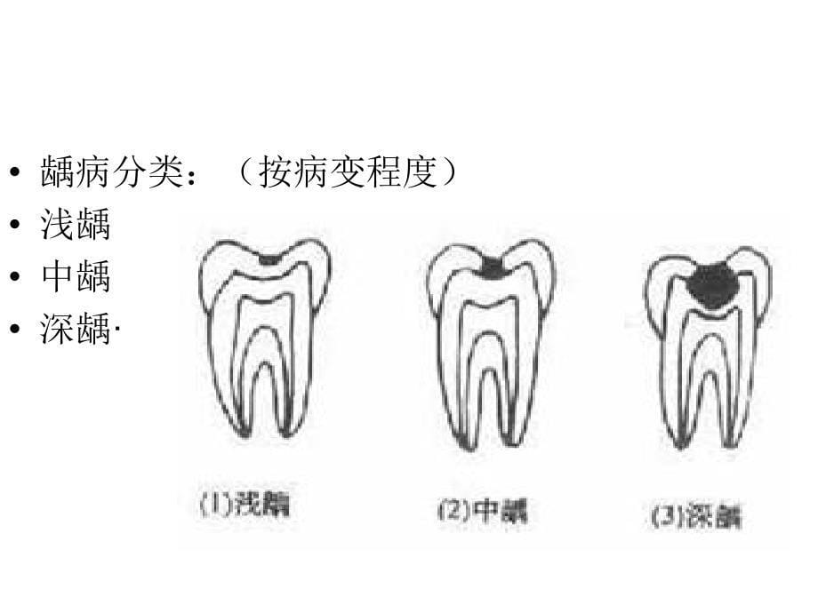 口腔内科病人的护理_第5页