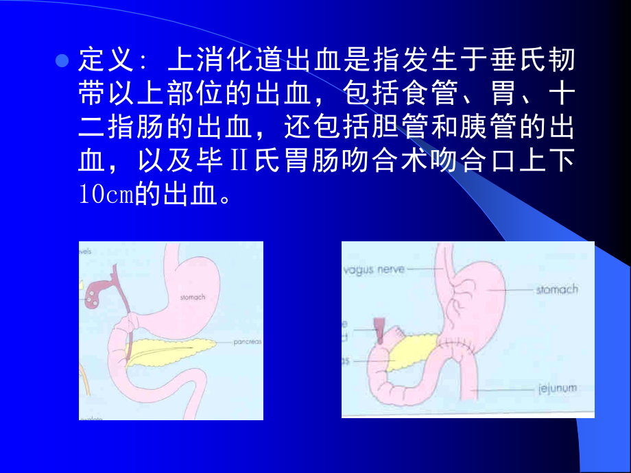 上消化道出血的诊断和处理_第2页