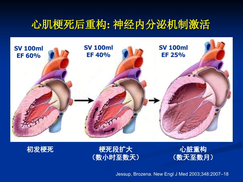 中国慢性心衰治疗指南_第4页