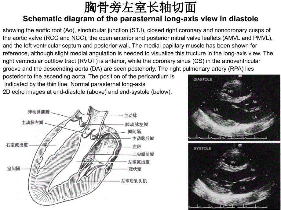 二维超声心动图常用切面及选择_第3页