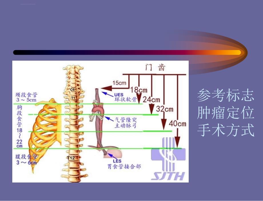 食管的临床应用解剖_第3页