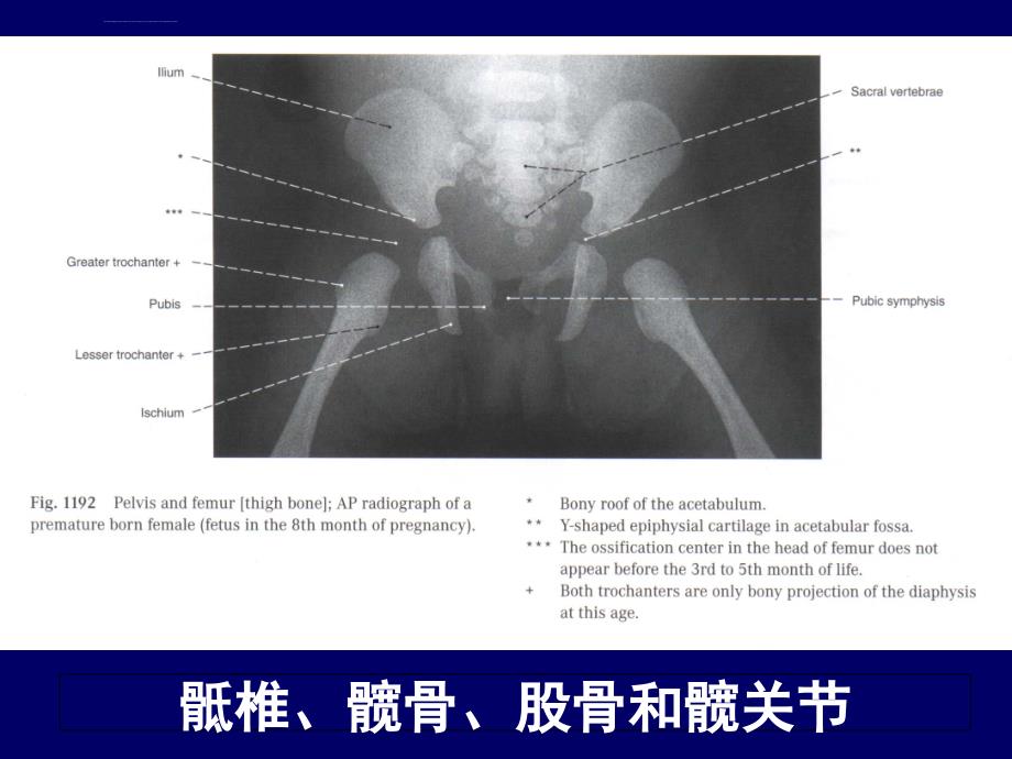 人体断层解剖学、下肢断层解剖_第3页