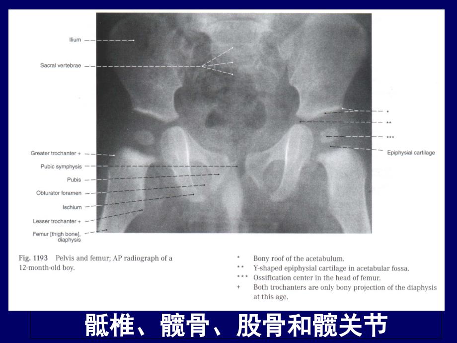 人体断层解剖学、下肢断层解剖_第4页