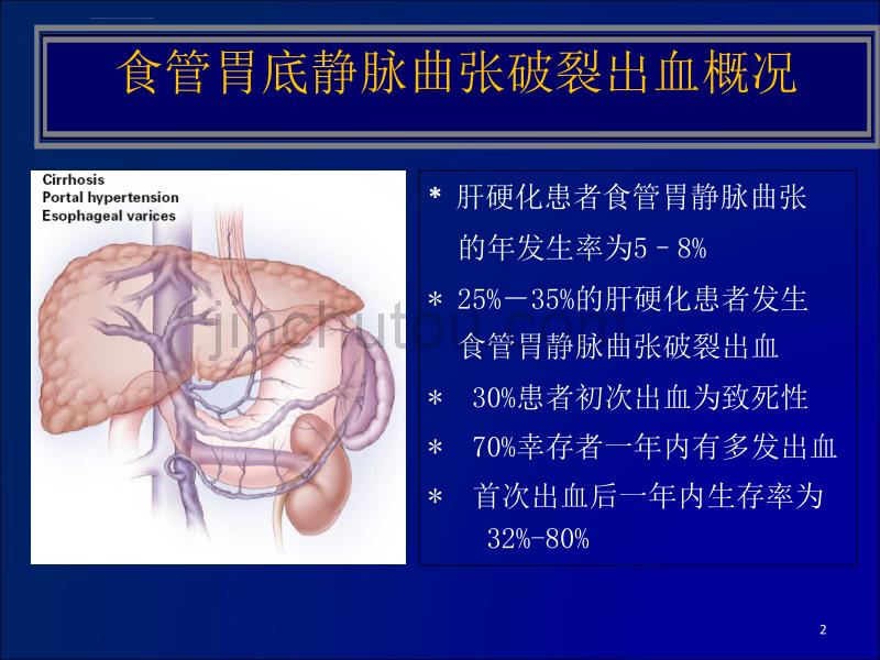 浅析食管胃底静脉曲张破裂出血的各种预防措施_第2页