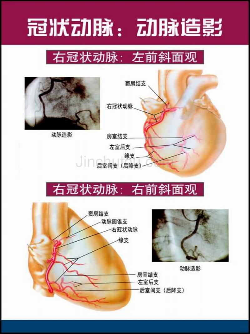 心脏解剖图med126com_第5页