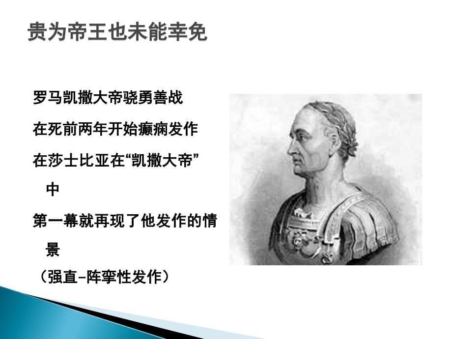 癫痫课程医学PPT_第5页