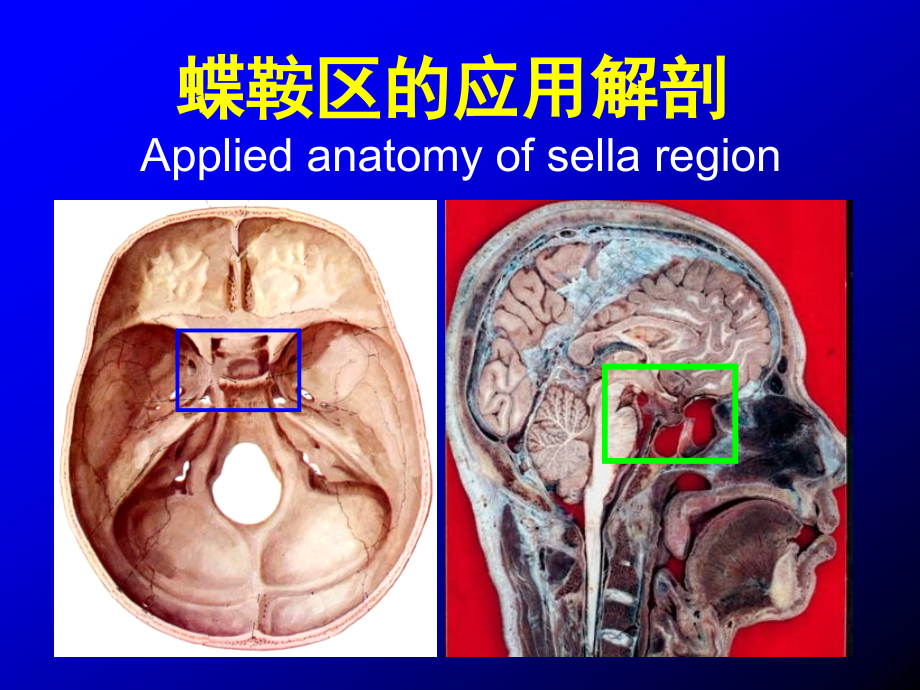 蝶鞍区断层解剖与影像对照医学PPT_第1页