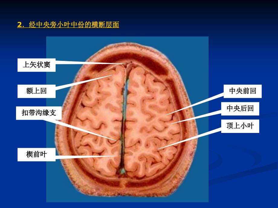 断层解剖切片PPT课件_第2页