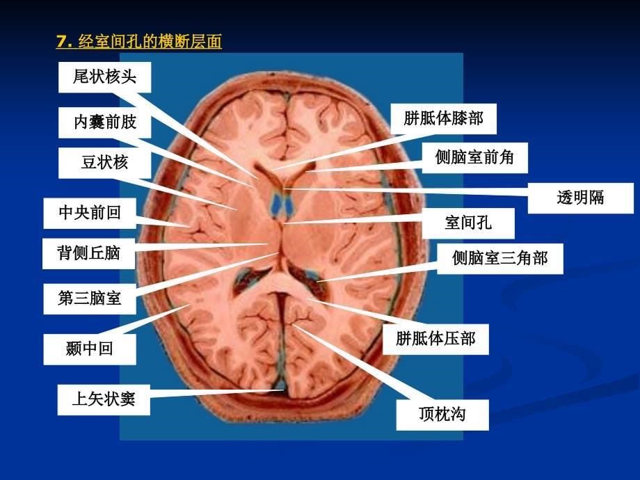 断层解剖切片PPT课件_第5页