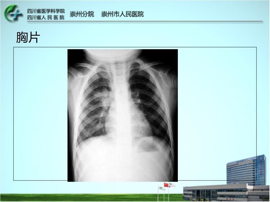 儿童社区获得性肺炎_2015.04_第5页