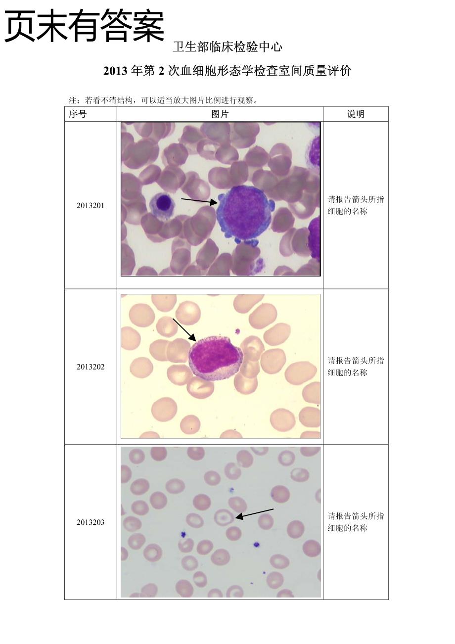 2013年第2次血细胞形态学室间质评及答案_第1页