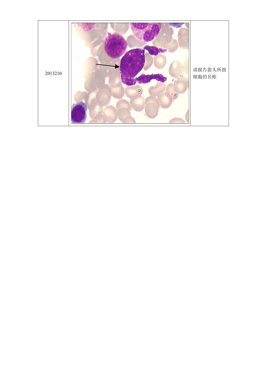 2013年第2次血细胞形态学室间质评及答案_第4页