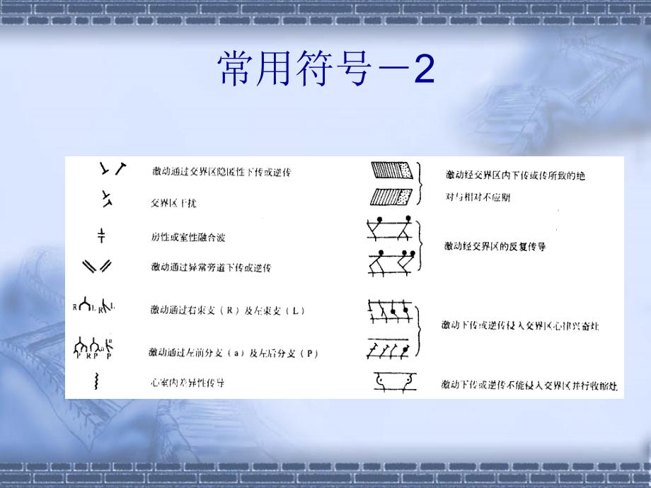 心律失常心电图解法_第4页