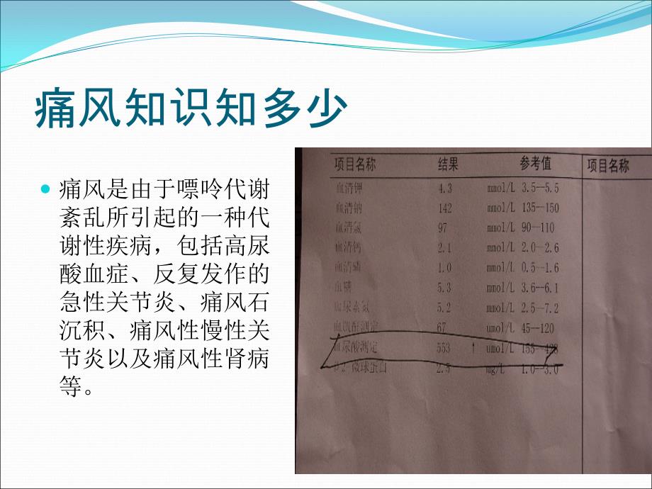 高尿酸和痛风患者的饮食管理医学PPT_第2页