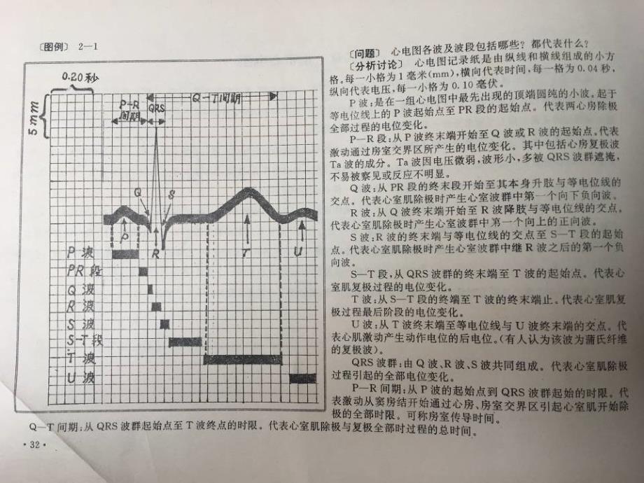 常见异常心电图诊断_第2页