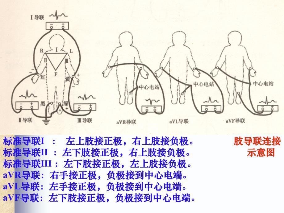 常见心电图诊断基础-教案之一_第5页