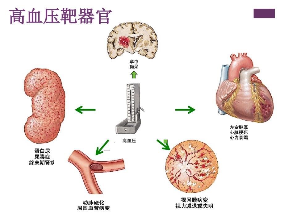 高血压与靶器官_第5页