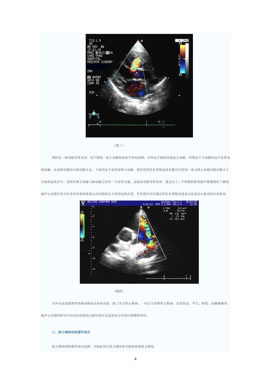 肺循环高压超声诊断_第4页