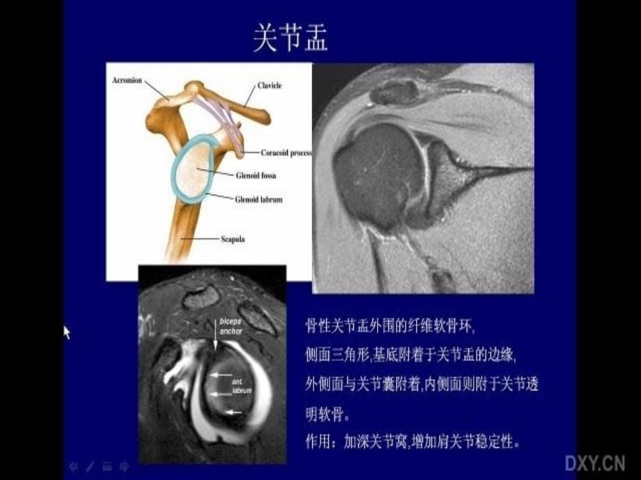 肩关节应用解剖及腱鞘肌腱病的磁共振影像诊断 杜湘科_第5页