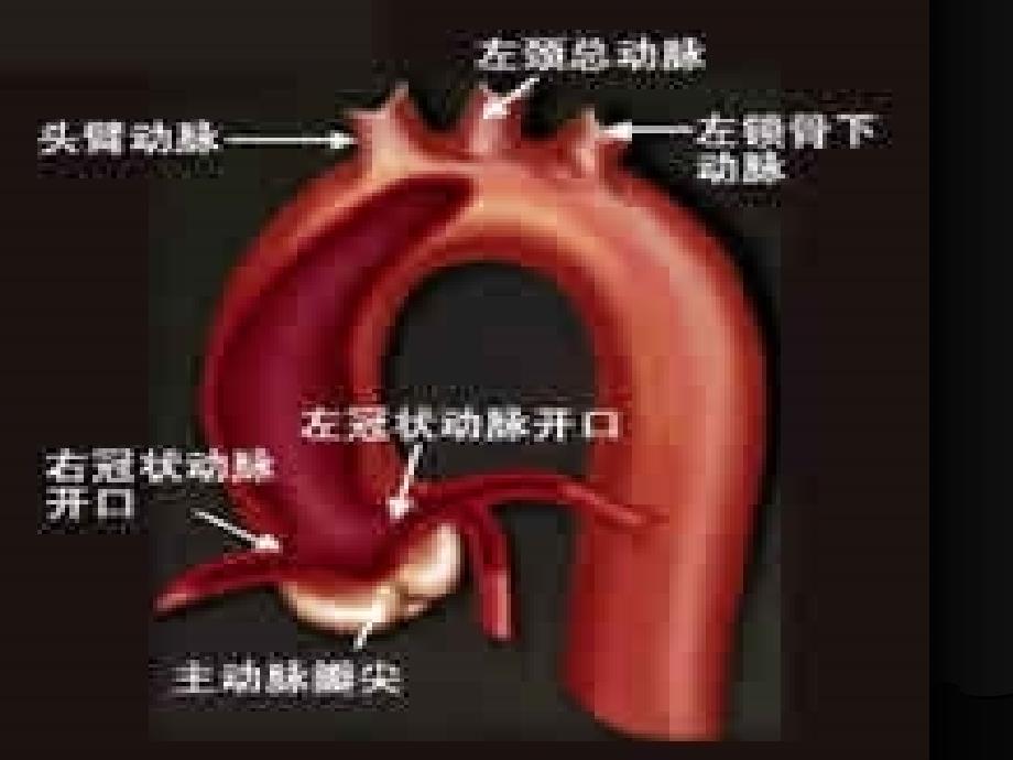 经股动脉冠脉造影术的术前术后护理 培训课件_第4页