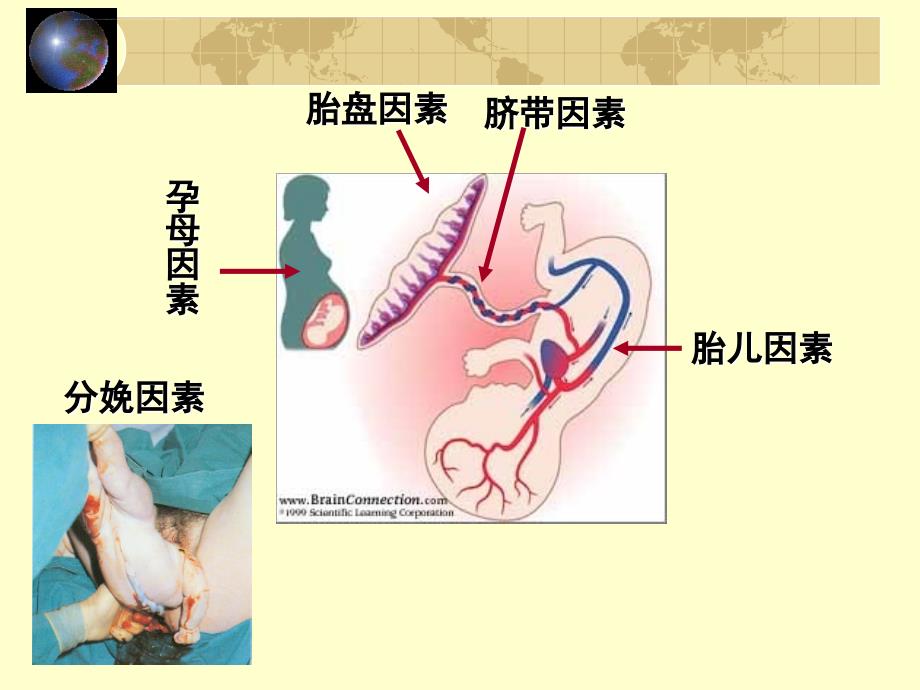 新生儿及新生儿疾病2ppt培训课件_第4页