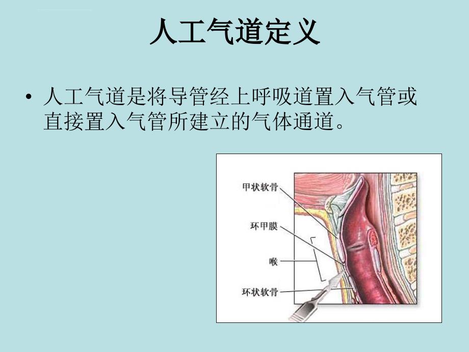 人工气道管理ppt培训课件_第2页