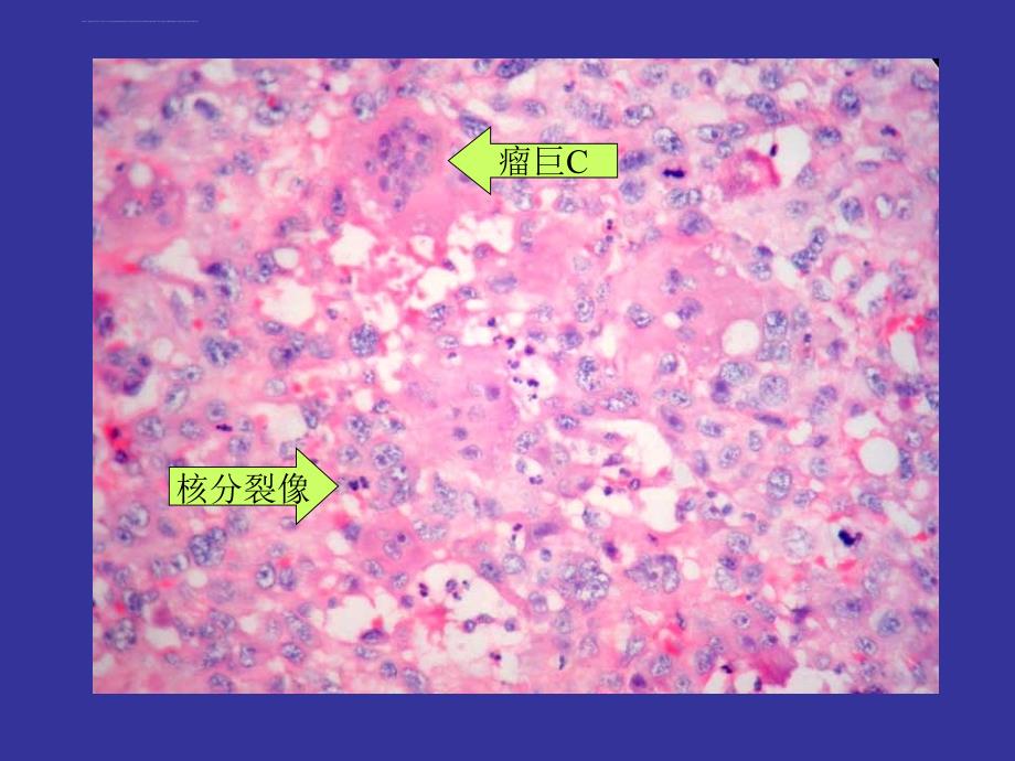 肿瘤 循环播放ppt培训课件_第1页