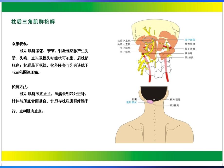 中华针刀治疗图解ppt培训课件_第4页