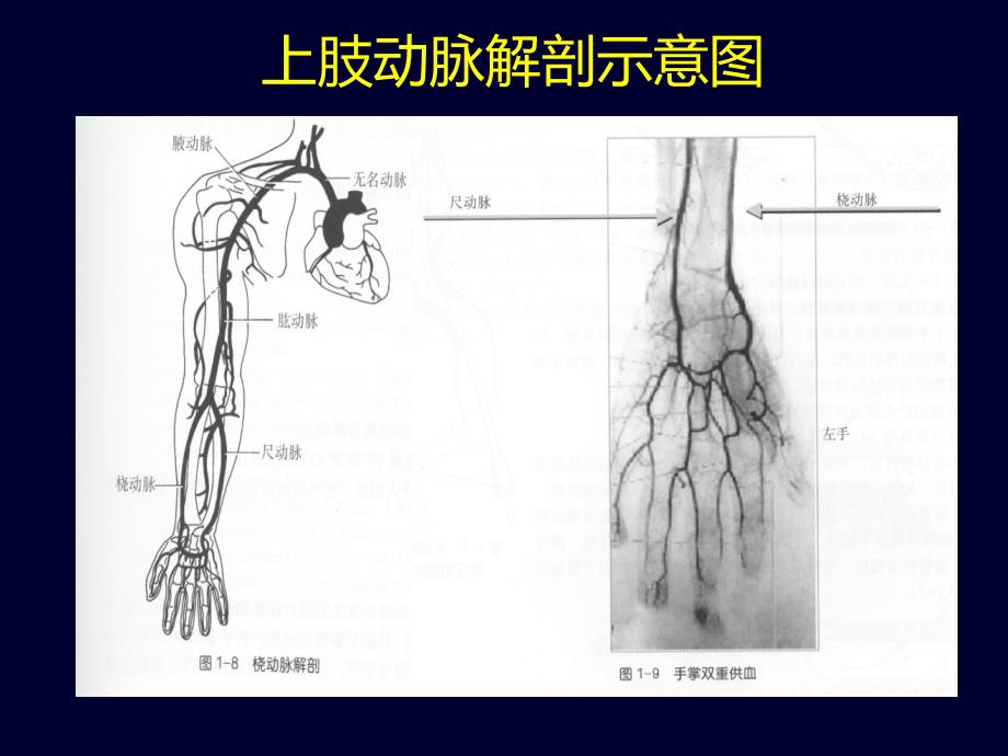 血管径路穿刺的技术难点与要点ppt培训课件_第4页