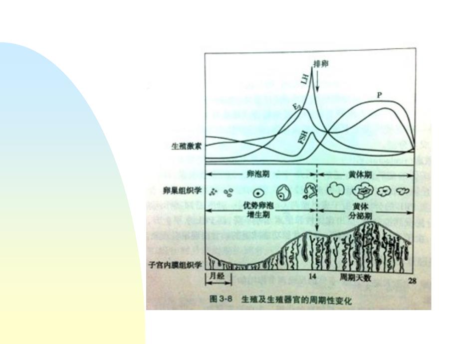 女性生殖内分泌疾病ppt培训课件_第4页