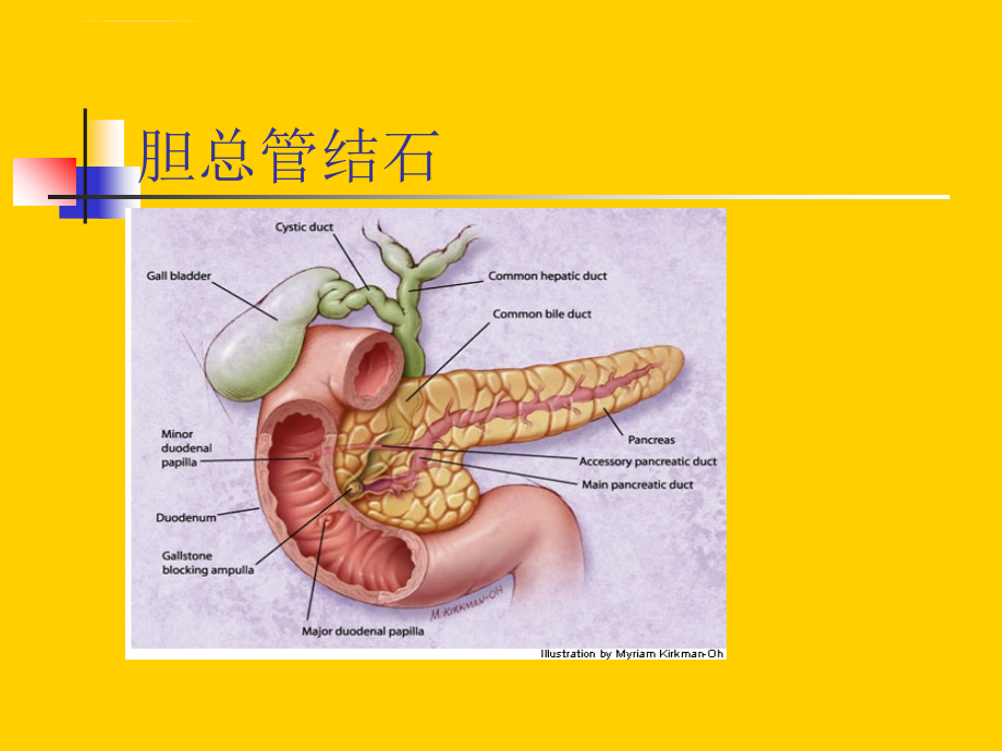 急性胰腺炎治疗ppt培训课件_第4页