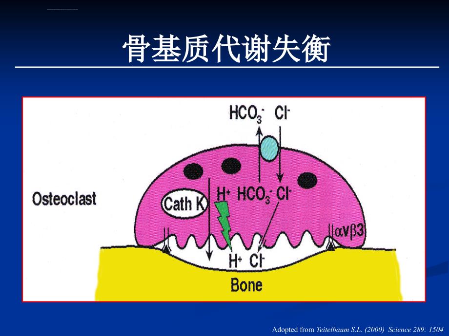 骨质疏松课件_第4页