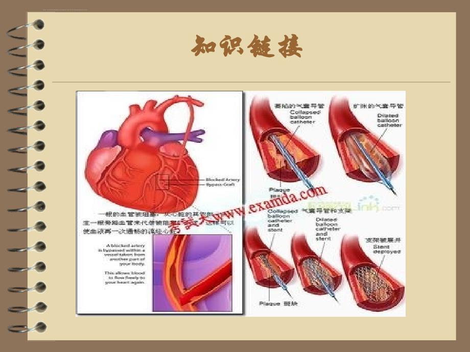 主动脉内球囊反搏术的基本原理（蔡泽超）ppt培训课件_第3页