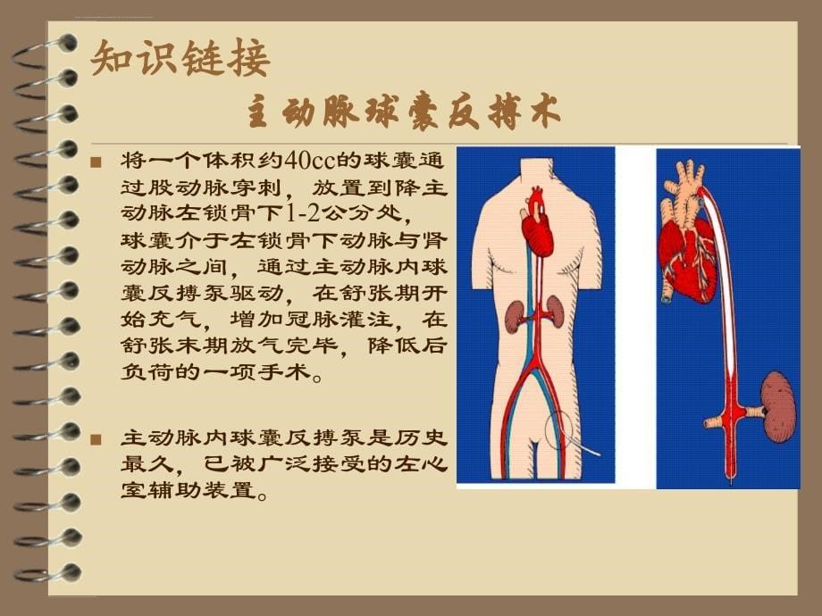 主动脉内球囊反搏术的基本原理（蔡泽超）ppt培训课件_第5页