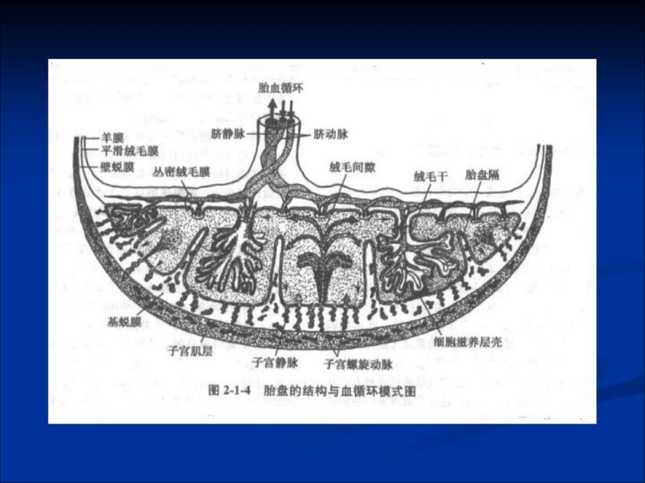 国家级精品课《妇产科学》胎儿窘迫早产相关综合症ppt培训课件_第4页