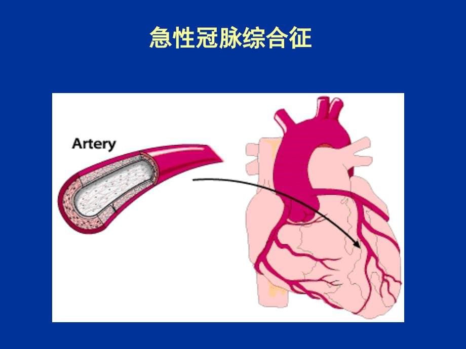 b阻滞剂与冠心病治疗1 p51_第5页