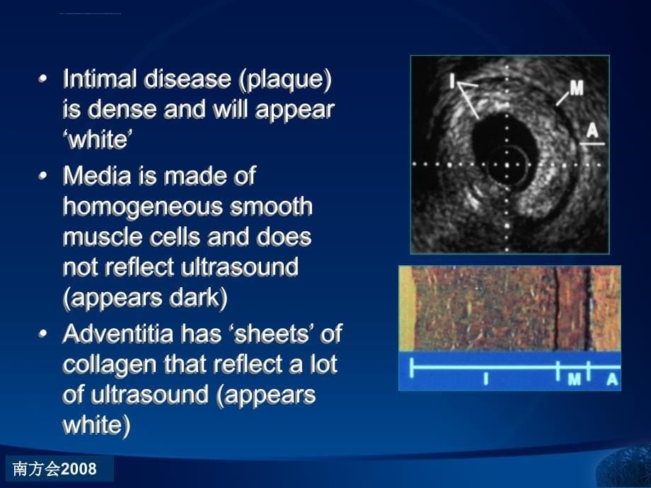 血管内超声基础知识ppt培训课件_第5页