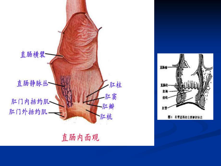 痔疮病人的护理ppt课件_第4页