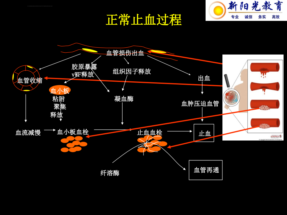 出血性疾病ppt培训课件_第4页