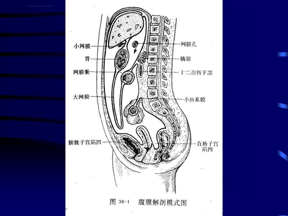 化脓性腹膜炎分析课件_第4页