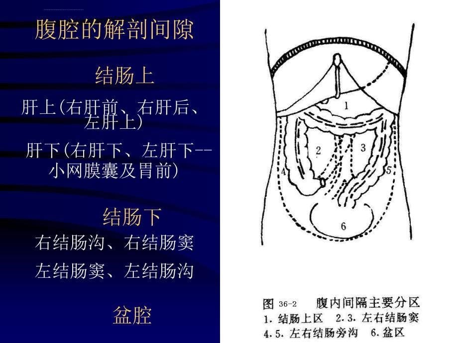 化脓性腹膜炎分析课件_第5页