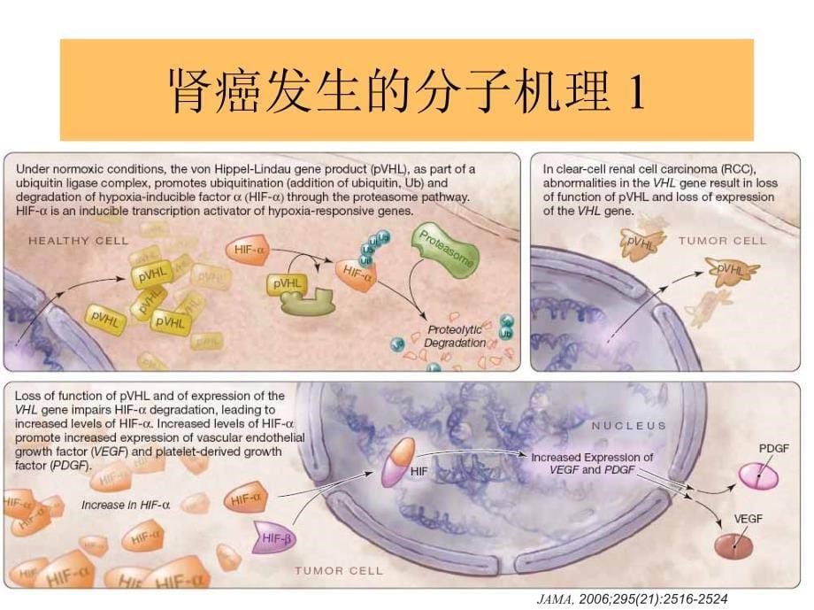 肾癌内科治疗朱晓东_第5页