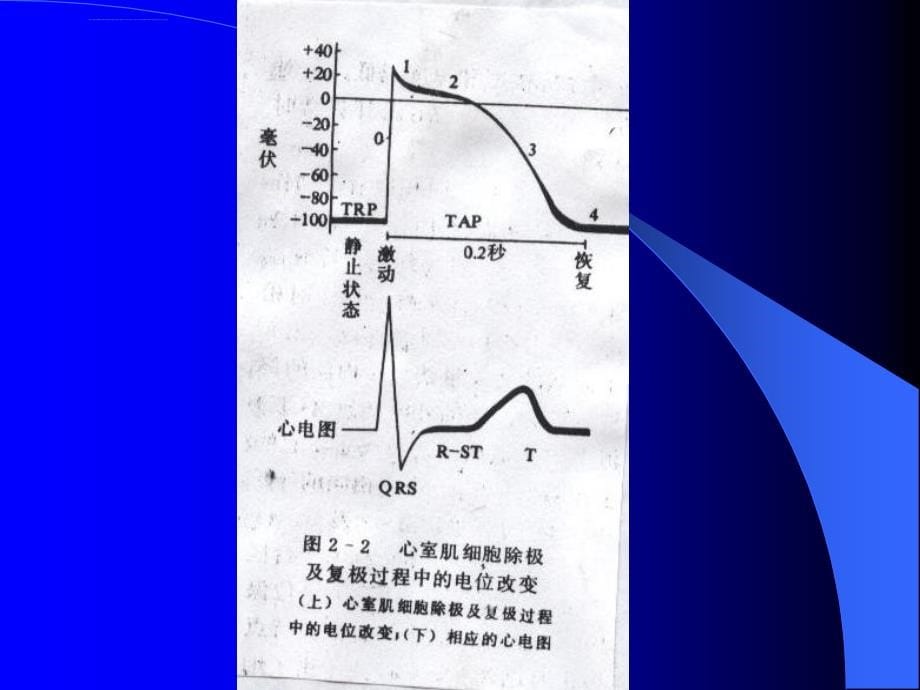 心电图1分析课件_第5页