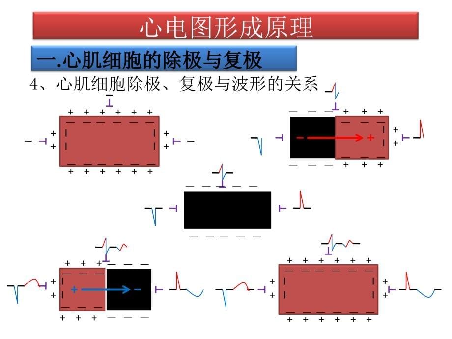 心电图(西安医学院讲课课件)_第5页