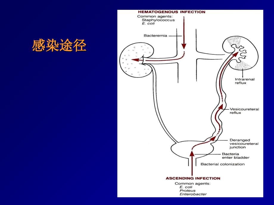 泌尿系统2课件_第3页