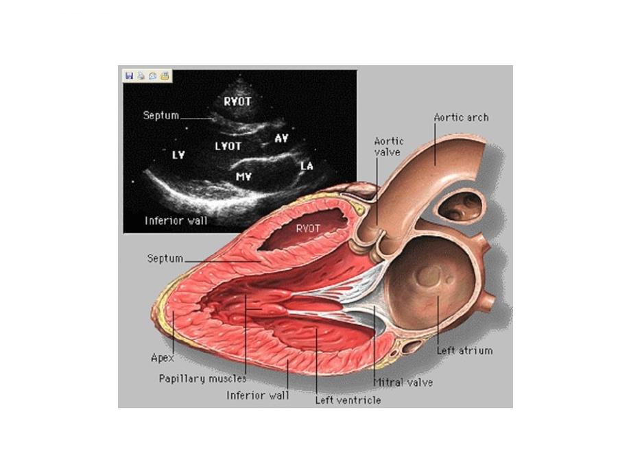 心脏超声对应解剖ppt培训课件_第1页