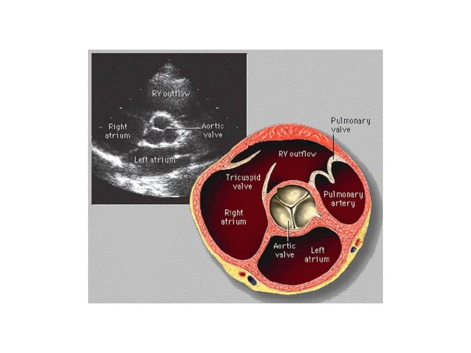 心脏超声对应解剖ppt培训课件_第3页