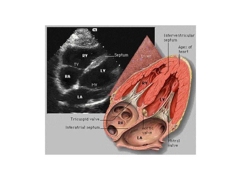 心脏超声对应解剖ppt培训课件_第4页