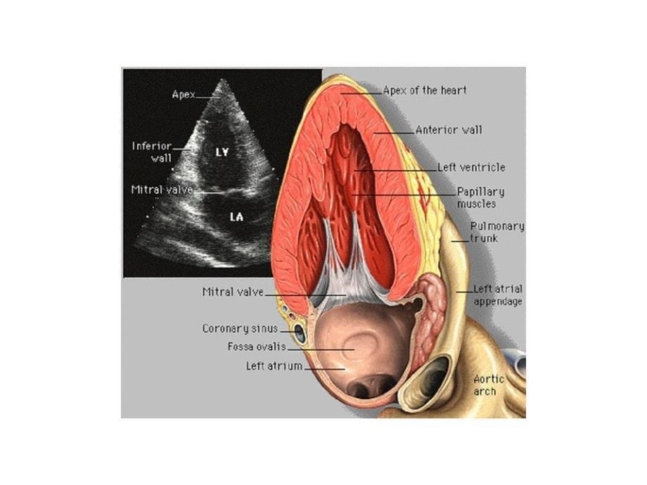 心脏超声对应解剖ppt培训课件_第5页